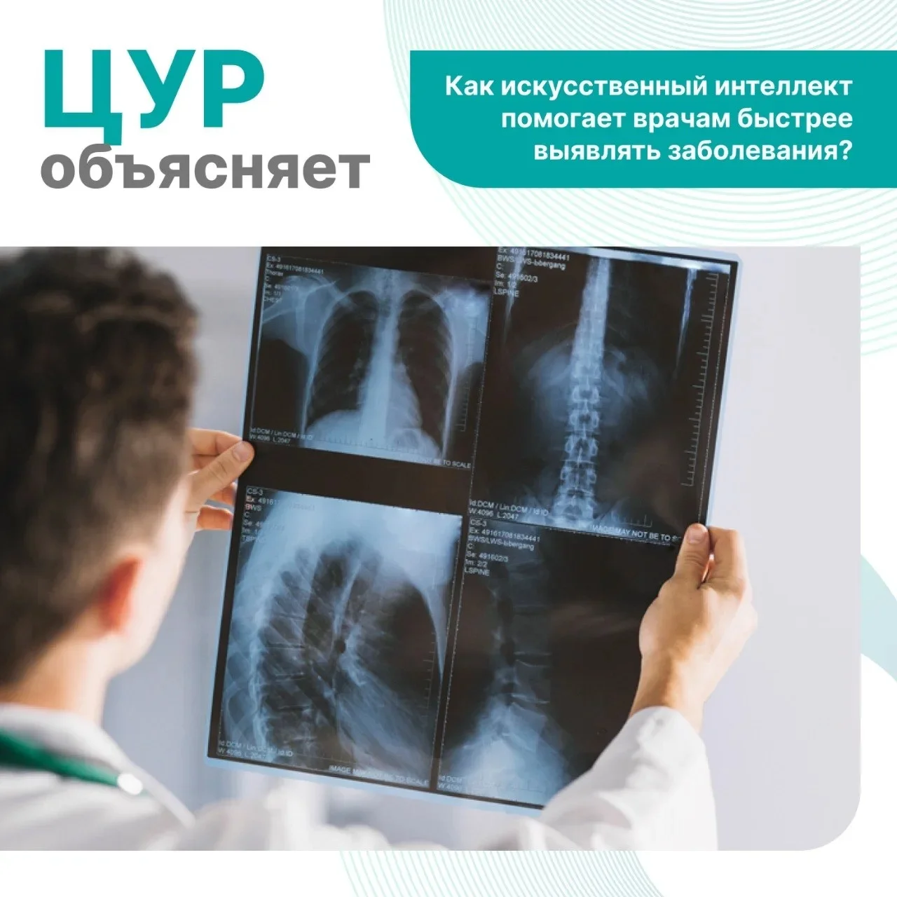 В Дагестане продолжают внедрять искусственный интеллект в здравоохранение